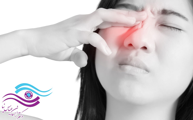 نکات مهمی که در مورد درد چشم باید بدانید