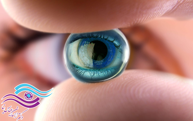 استفاده از لنز طبی بهتر است یا جراحی لیزیک؟