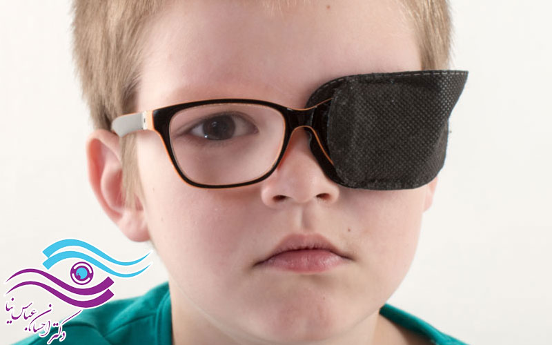 نحوه تشخیص و درمان تنبلی چشم
