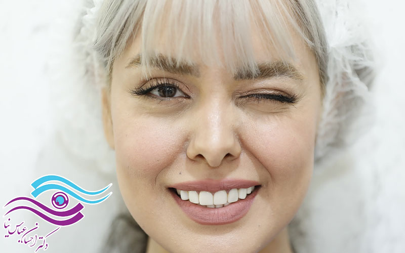 مراقبت های بعد از جراحی لیفت شقیقه و ابرو