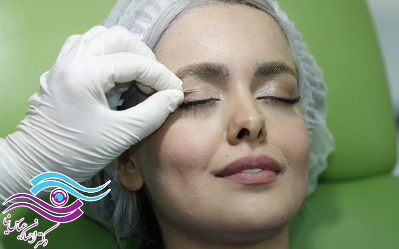 بهترین تکنیک برای جراحی زیبایی پلک بالا و پایین