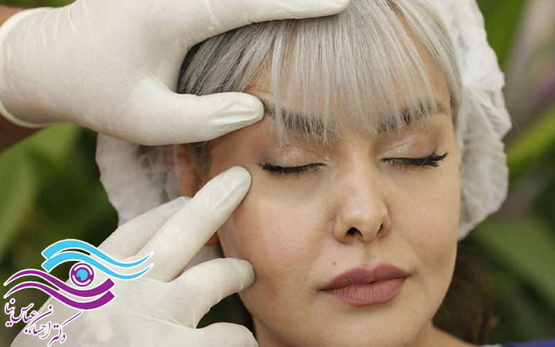 آیا جراحی زیبایی پلک دائمی است