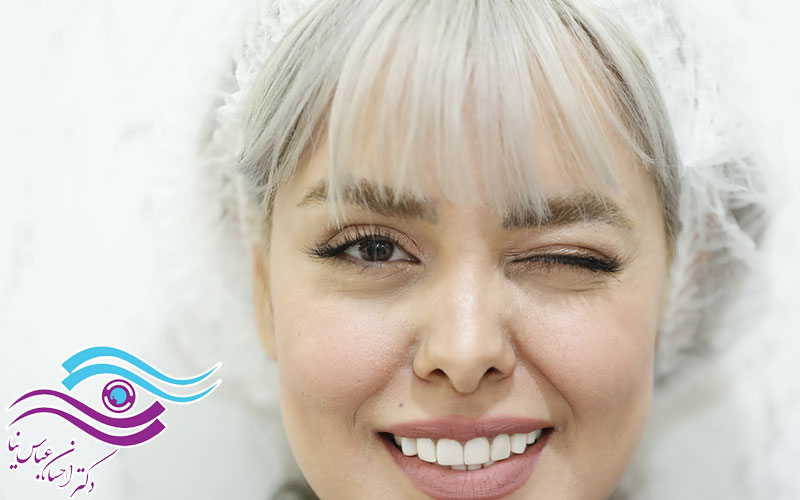 تکنیک های نوین در جراحی زیبایی پلک