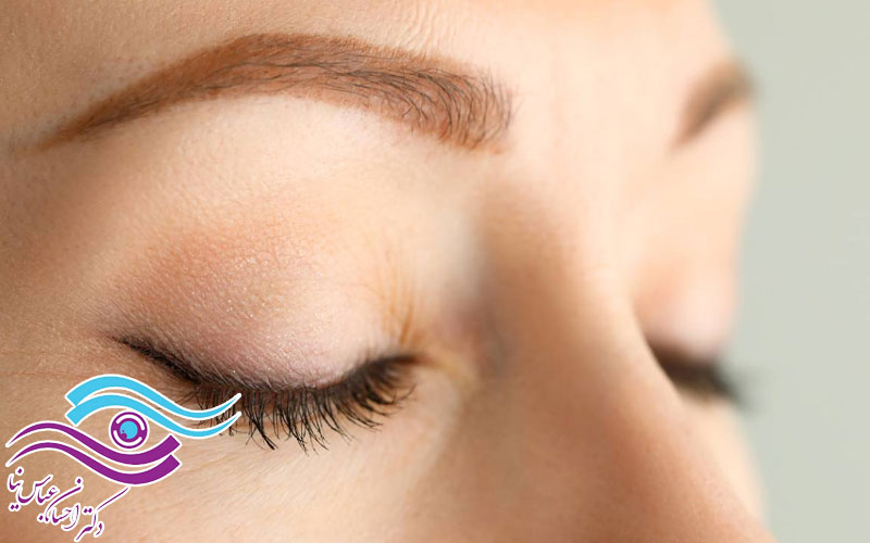 تاثیر نور خورشید و اشعه UV