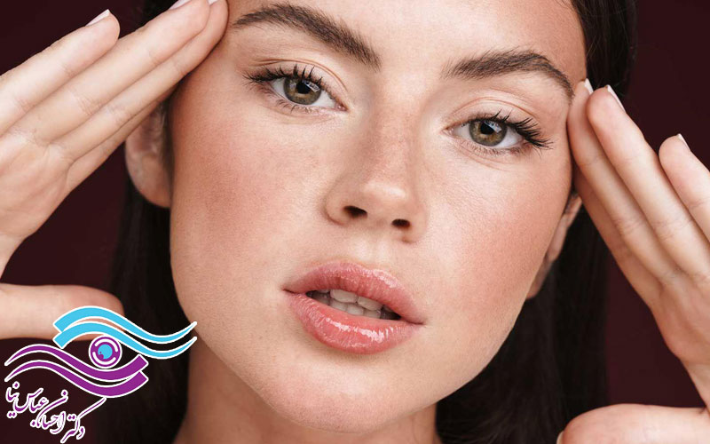 لیفت شقیقه برای رفع افتادگی گوشه چشم