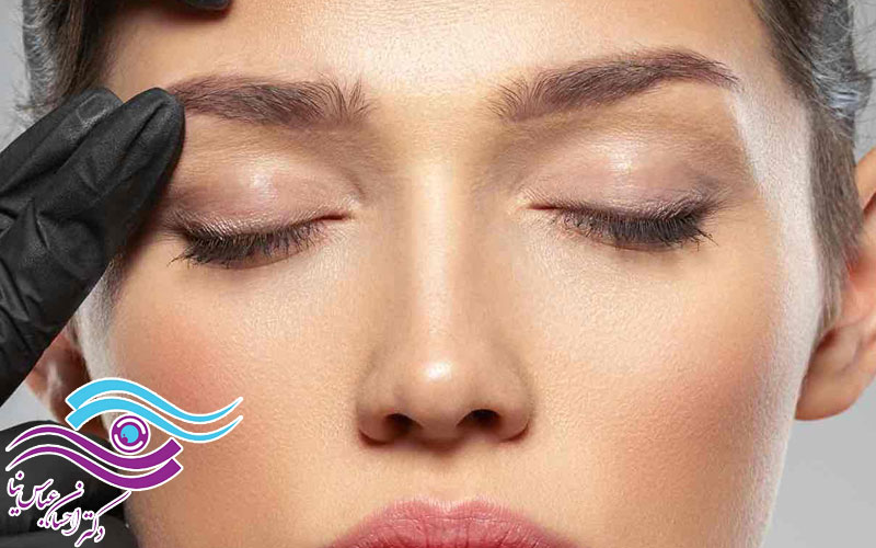درمان عوارض احتمالی پس از جراحی لیفت ابرو و شقیقه