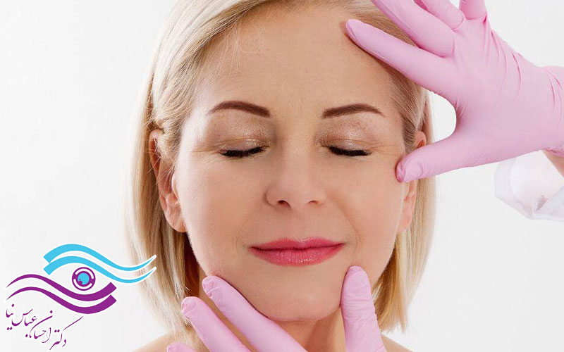 مقایسه ماندگاری لیفت شقیقه با لیفت ابرو