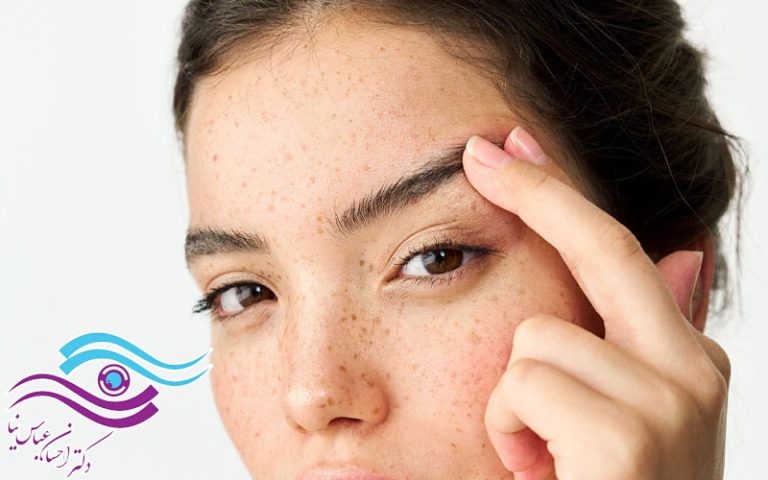 آیا انجام لیفت ابرو در سنین پایین توصیه می شود