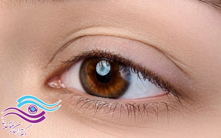 رد بخیه پلک شرقی کی از بین می رود