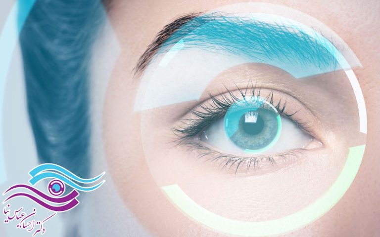 آیا لیزیک هر دو چشم در یک روز انجام می‌شود