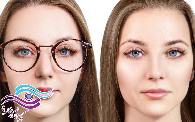آیا لیزیک همیشه عینک را حذف می‌کند